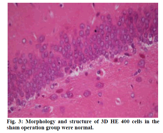 IJPS-structure