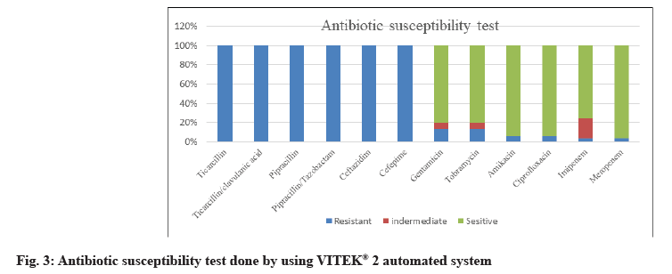 IJPS-susceptibility