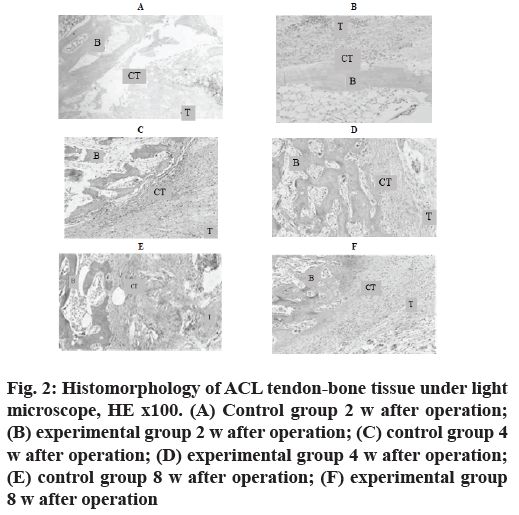 IJPS-tendon