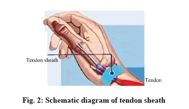 IJPS-tendon-sheath