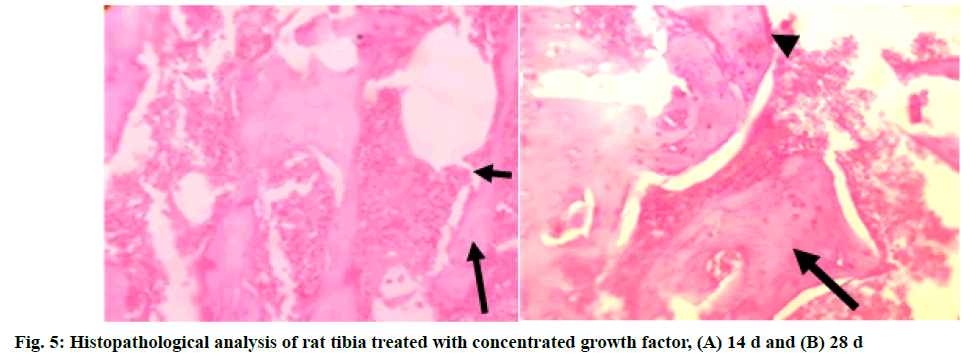 IJPS-tibia