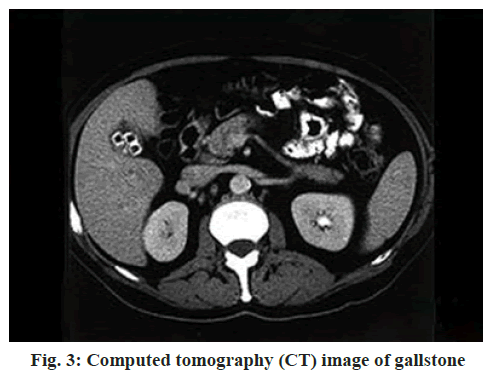 IJPS-tomography