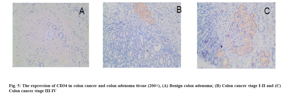 IJPS-84-S4-adenoma