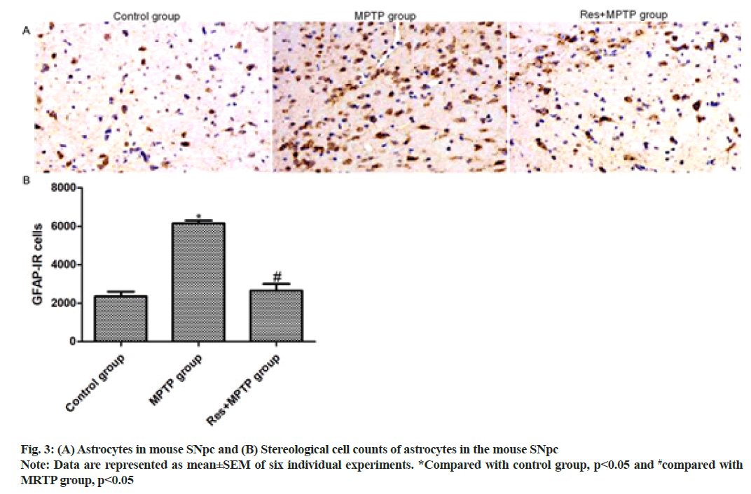 IJPS-Astrocytes