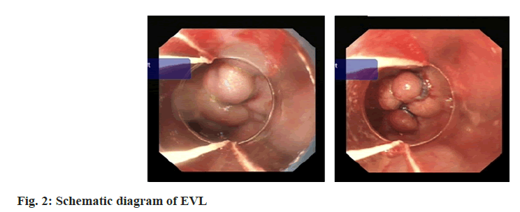 IJPS-EVL