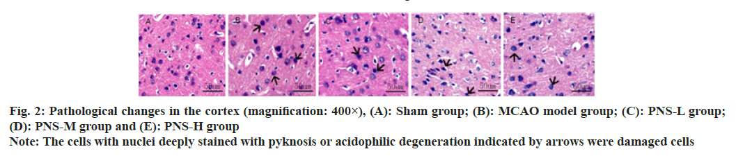 IJPS-Pathological