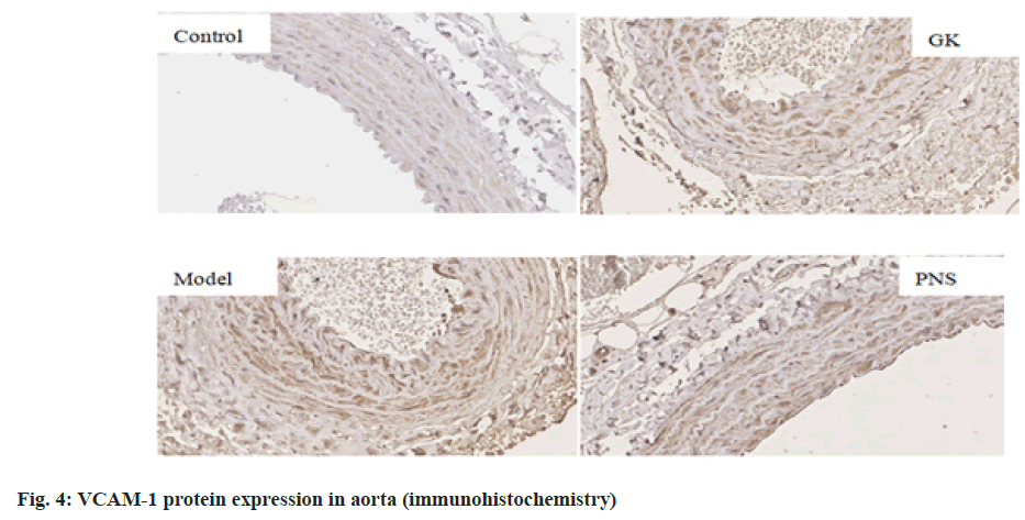 IJPS-VCAM-in