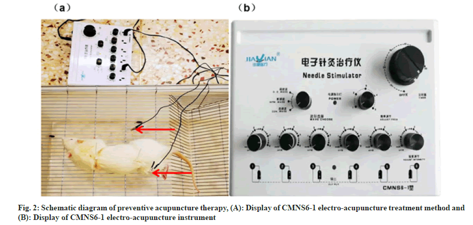 IJPS-acupunture