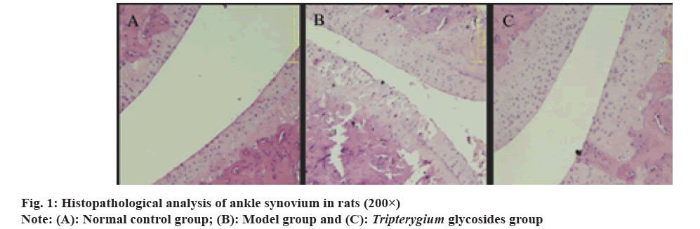 IJPS-ankle