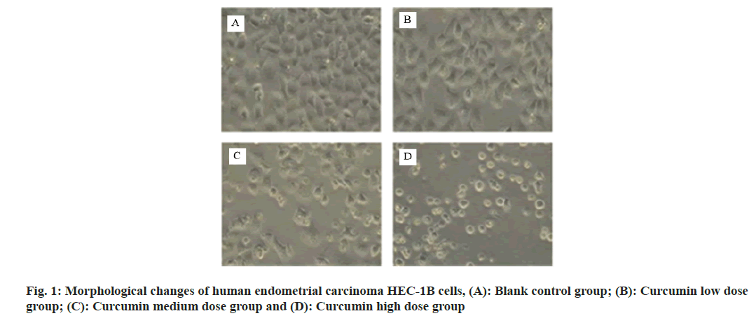 IJPS-carcinoma