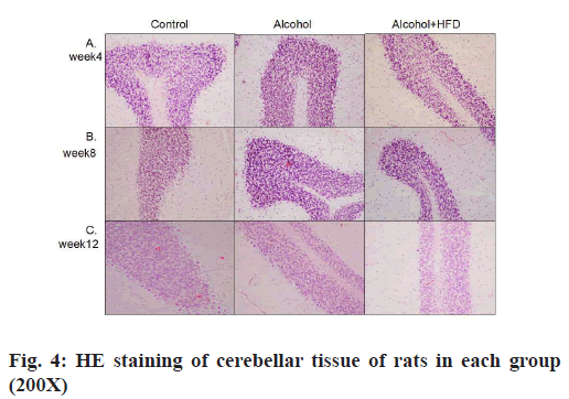 IJPS-cerebellar