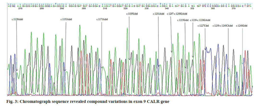 IJPS-chromatograph