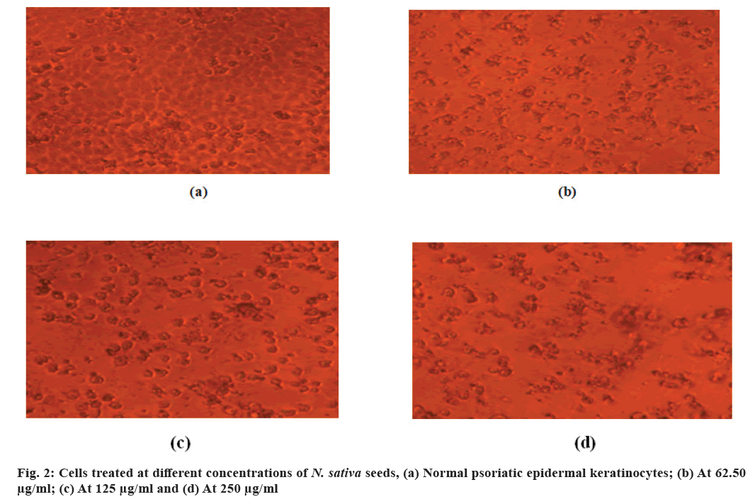 IJPS-concentrations