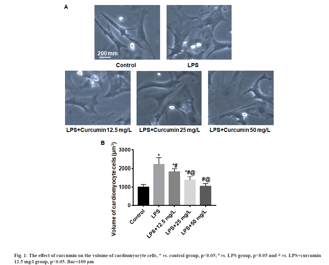 IJPS-curcumin