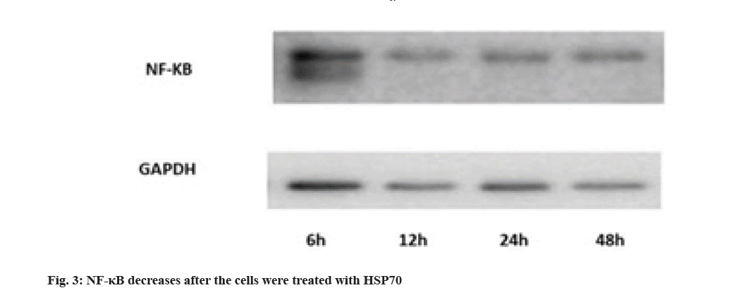 IJPS-decreases