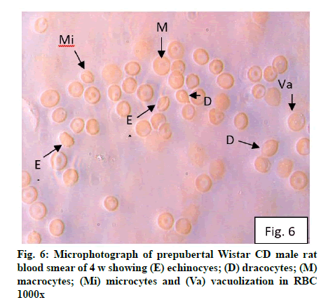 IJPS-echinocyes