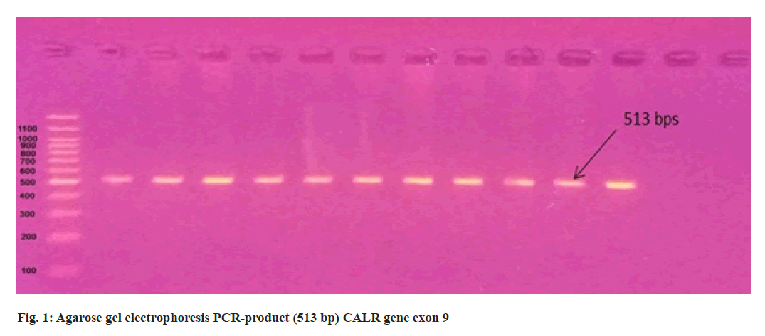 IJPS-electrophoresis