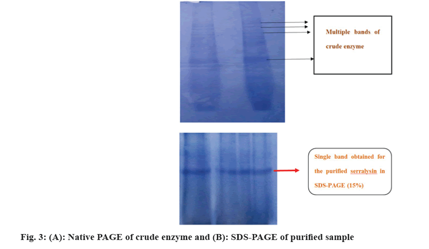 IJPS-enzyme