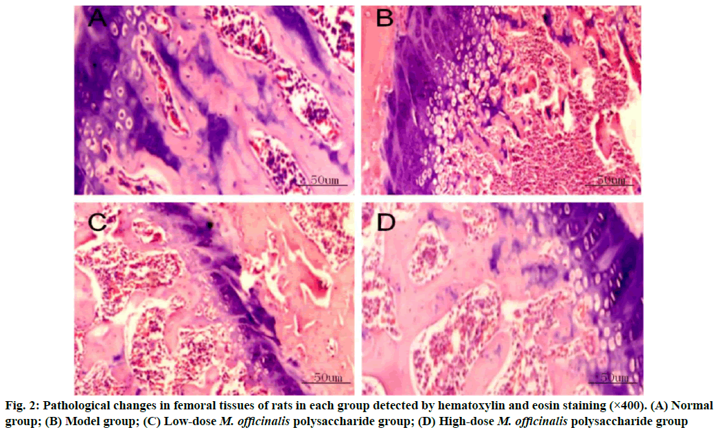 femoral