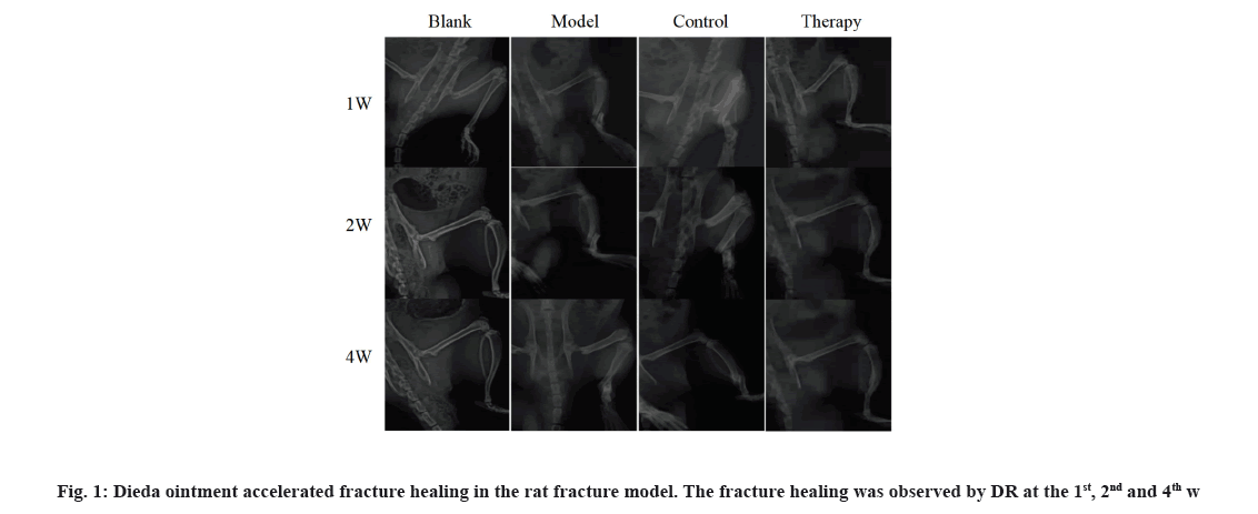 IJPS-fracture