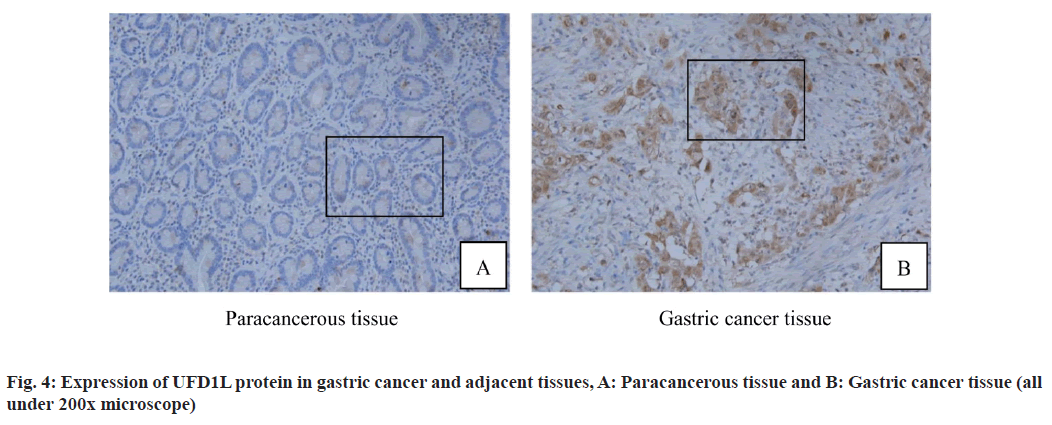 IJPS-gastric