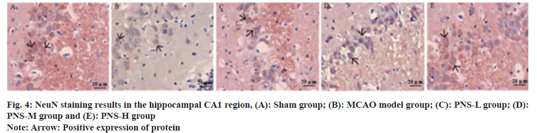 IJPS-hippocampal