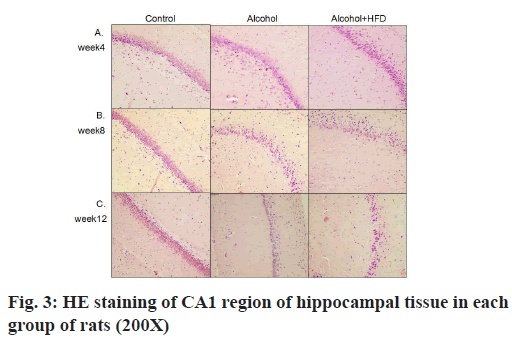 IJPS-hippocampal