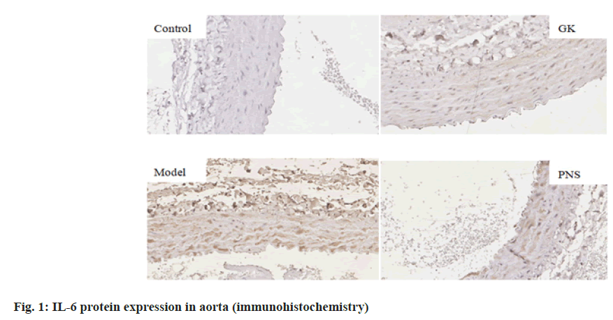 IJPS-in-aorta