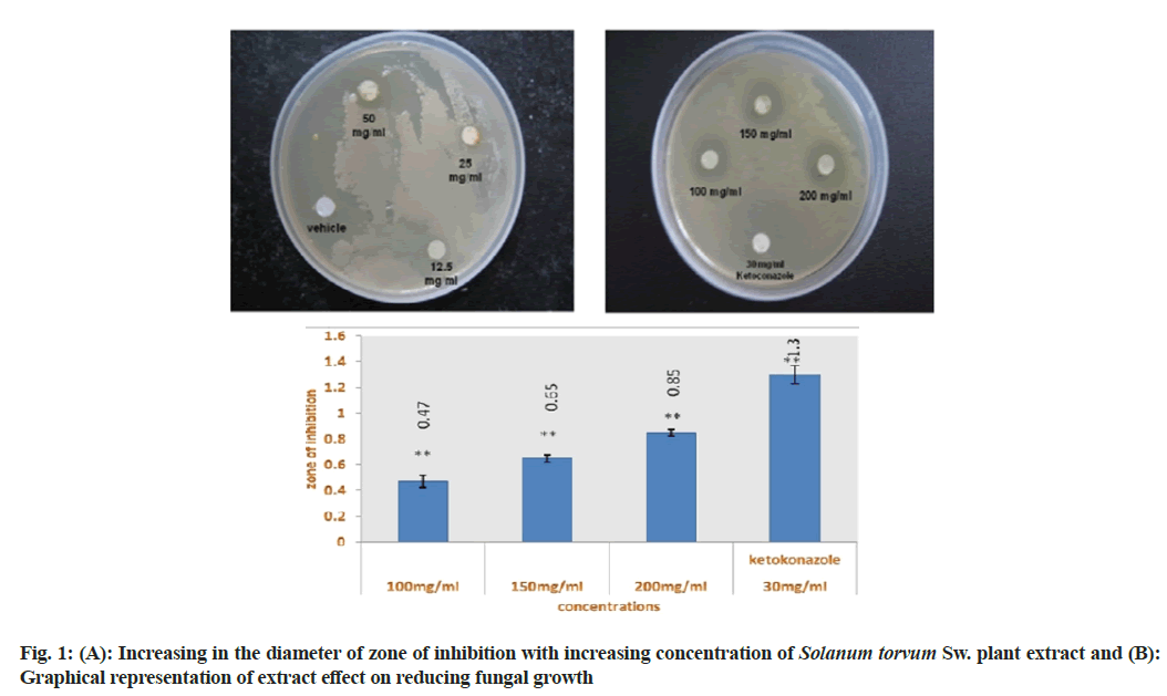 IJPS-inhibition