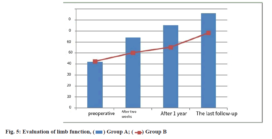 IJPS-limb