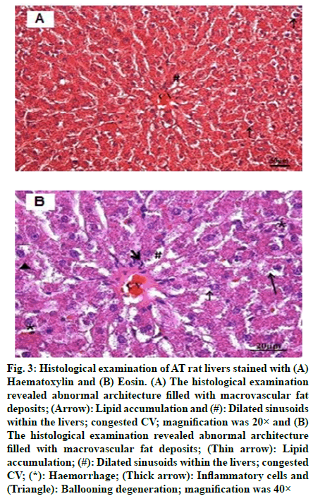 IJPS-macrovascular