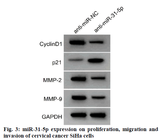 IJPS-migration