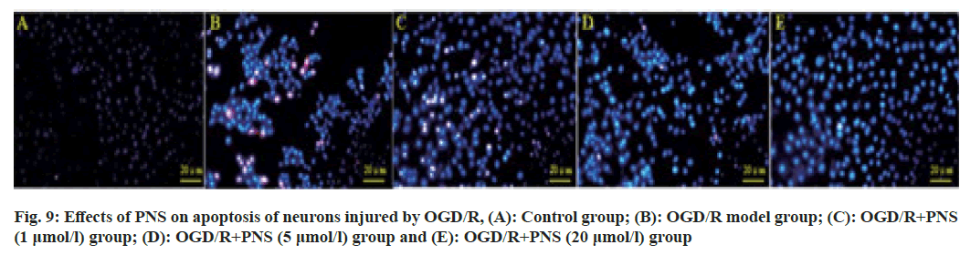 IJPS-neurons