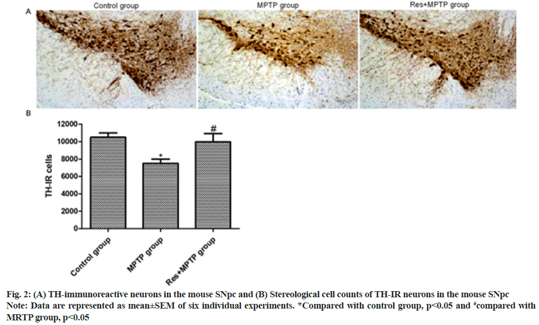 IJPS-neurons