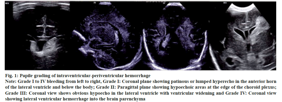 IJPS-periventricular