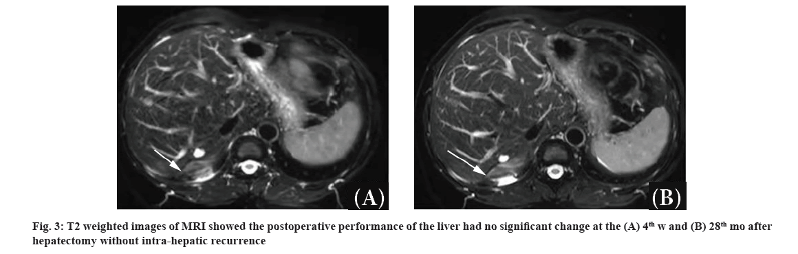 IJPS-postoperative