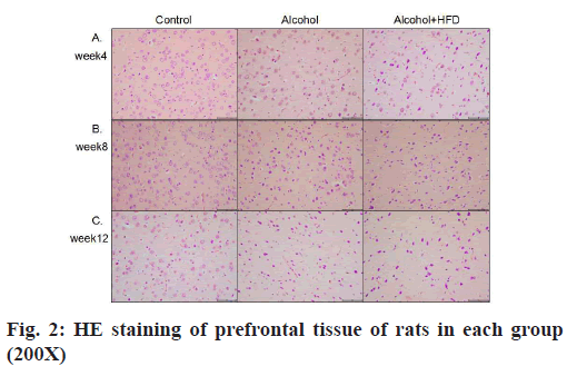 IJPS-prefrontal