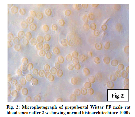 IJPS-prepubertal