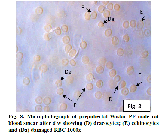 IJPS-prepubertal