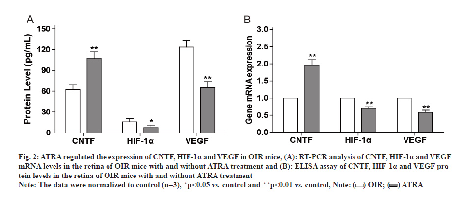 IJPS-retina