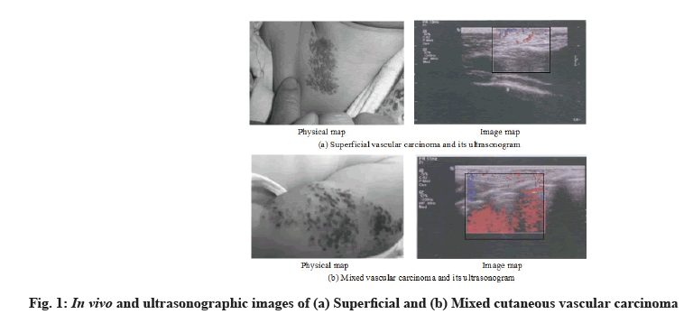 IJPS-ultrasonographic