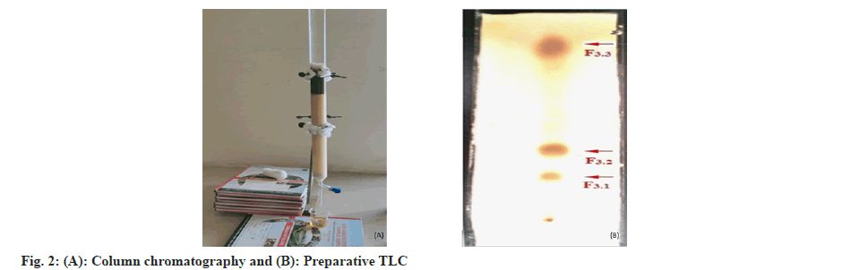 chromatography