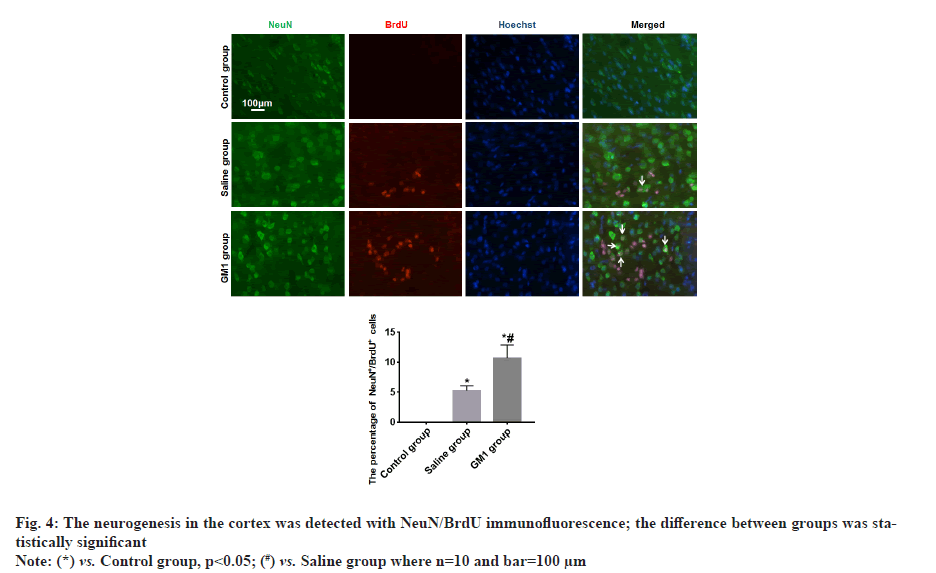 neurogenesis