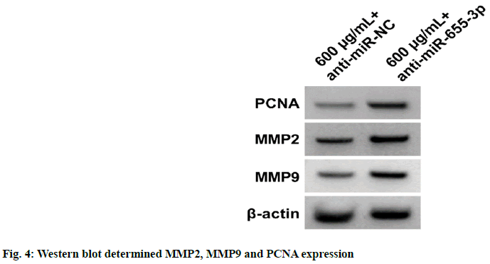 IJPS-MMP9