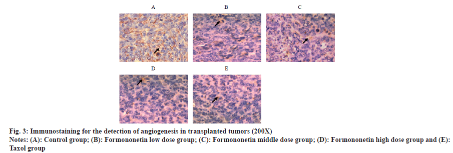 IJPS-detection