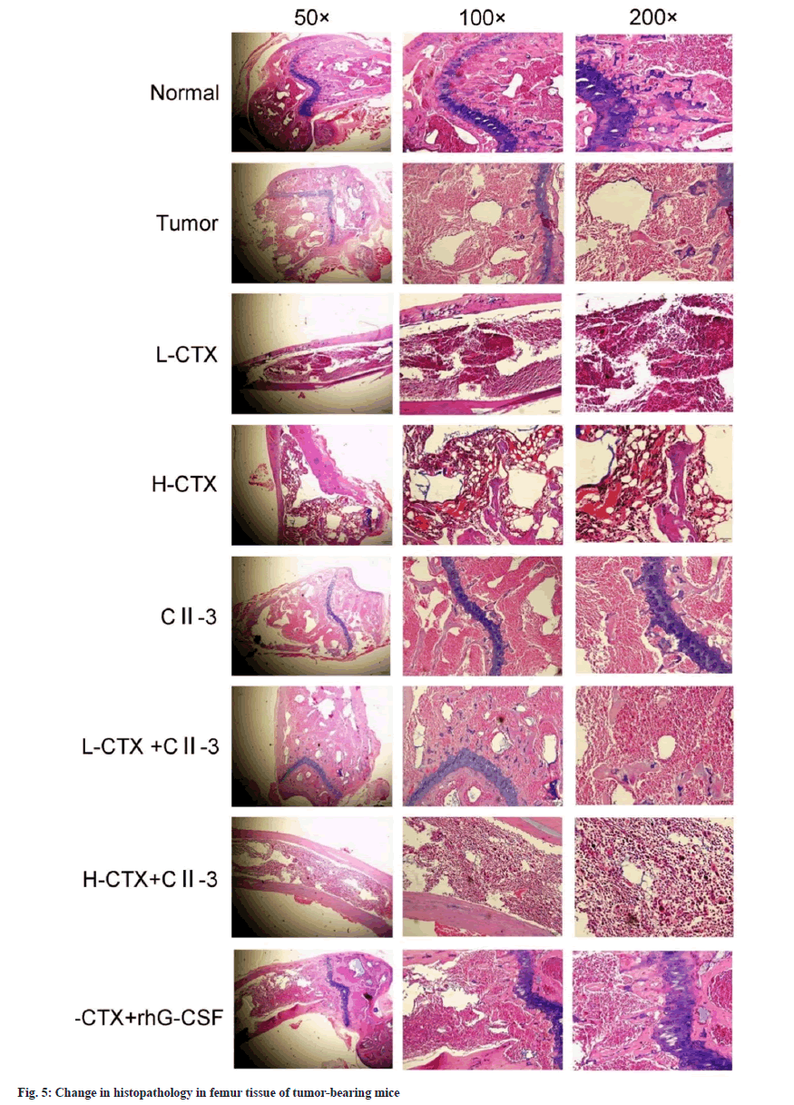 IJPS-femur