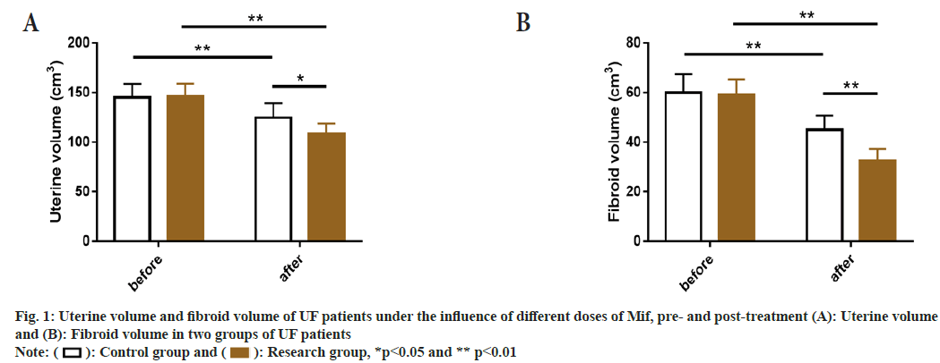 IJPS-fibroid