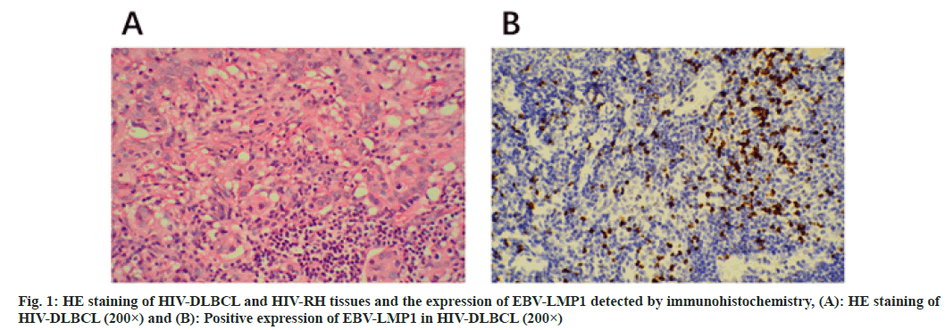 immunohistochemistry