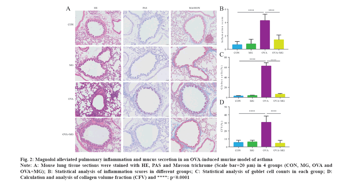 IJPS-inflammation