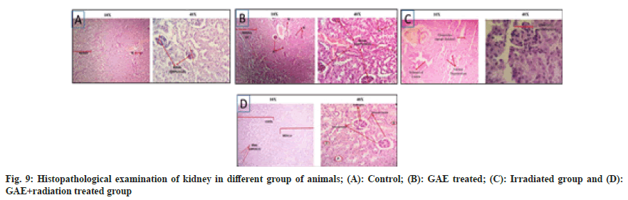 IJPS-kidney